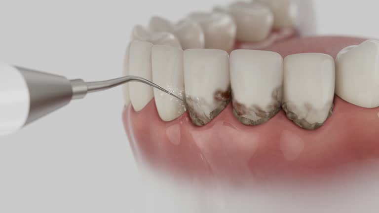 Reliable Dental Implants contractor in Mannington, WV by Smile Center Dentistry